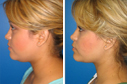 Before & After Photos